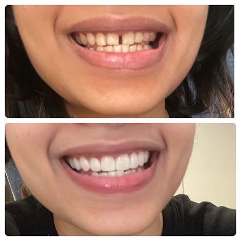 1633 best r/askdentists images on Pholder .